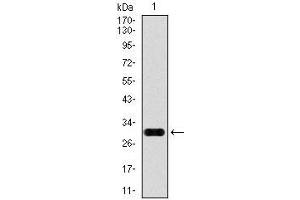 Western Blotting (WB) image for anti-Glypican 3 (GPC3) antibody (ABIN969523)