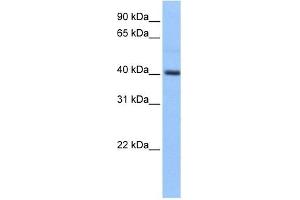 PDXK antibody used at 1 ug/ml to detect target protein. (PDXK antibody)