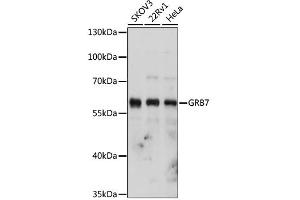 Western blot analysis of extracts of various cell lines, using GRB7 antibody (ABIN1876891) at 1:1000 dilution. (GRB7 antibody)