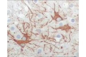 Immunohistochemistry (IHC) image for anti-Feline Sarcoma Oncogene (FES) (truncated) antibody (ABIN2464051) (FES antibody  (truncated))