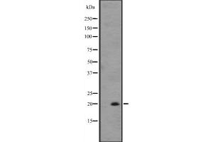Western blot analysis of IL25 expression in ZR-75-1 cell line lysates ,The lane on the left is treated with the antigen-specific peptide. (IL-25 antibody  (Internal Region))