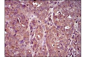 Immunohistochemistry (IHC) image for anti-Interleukin 3 Receptor, alpha (IL3RA) (AA 200-305) antibody (ABIN1724855)