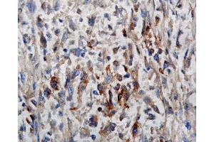 Immunohistochemistry (IHC) image for anti-Phosphotyrosine antibody (ABIN361758)