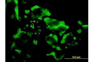 Image no. 2 for anti-Eukaryotic Translation Initiation Factor 4E Family Member 2 (EIF4E2) (AA 1-246) antibody (ABIN599082) (EIF4E2 antibody  (AA 1-246))