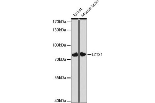 LZTS1抗体（AA 337-596）