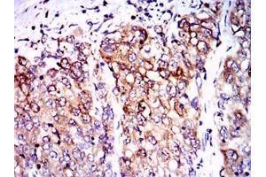 Immunohistochemistry (IHC) image for anti-Protein Phosphatase 2A Activator, Regulatory Subunit 4 (PPP2R4) antibody (ABIN969557)