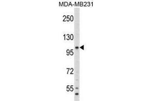 Image no. 1 for anti-Complement Component 6 (C6) (N-Term) antibody (ABIN452791) (C6 antibody  (N-Term))