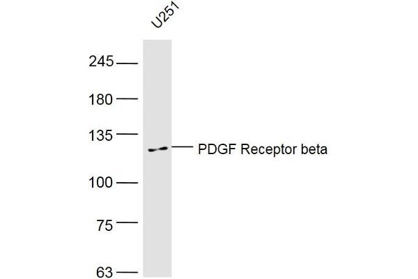 PDGFRB antibody  (AA 981-1066)