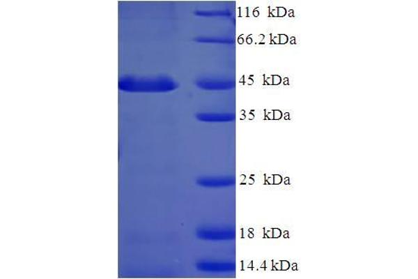 PSMF1 Protein (AA 1-271, full length) (His-SUMO Tag)