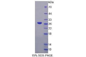 Image no. 1 for G Elongation Factor, Mitochondrial 2 (GFM2) (AA 570-779) protein (His tag) (ABIN6239704) (GFM2 Protein (AA 570-779) (His tag))