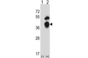 Western Blotting (WB) image for anti-General Transcription Factor IIB (GTF2B) antibody (ABIN2997924) (GTF2B antibody)