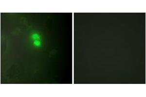 Immunofluorescence (IF) image for anti-Dyskeratosis Congenita 1, Dyskerin (DKC1) (AA 171-220) antibody (ABIN2889340) (DKC1 antibody  (AA 171-220))