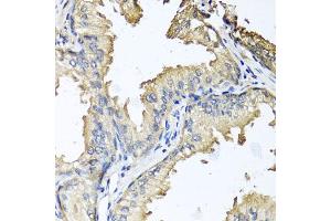 Immunohistochemistry of paraffin-embedded human prostate using CXCR4 antibody. (CXCR4 antibody)