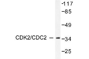 Image no. 1 for anti-Cyclin-Dependent Kinase 2 (CDK2) antibody (ABIN265345) (CDK2 antibody)