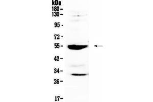 Western blot analysis of MMP13 using anti-MMP13 antibody . (MMP13 antibody  (AA 99-335))