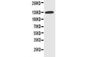 Anti-NKCC1 antibody, Western blotting WB: HELA Cell Lysate (SLC12A2 antibody  (N-Term))