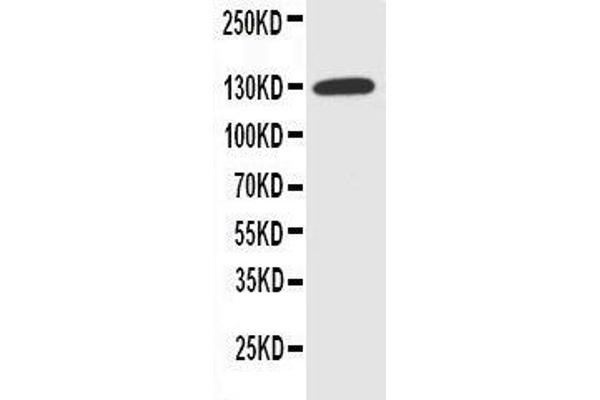 SLC12A2 antibody  (N-Term)