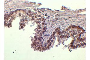 Immunohistochemistry (IHC) image for anti-Forkhead Box A1 (FOXA1) antibody (ABIN5865835) (FOXA1 antibody)