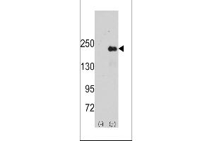 Western blot analysis of SPAG9 using rabbit polyclonal SPAG9 Antibody using 293 cell lysates (2 ug/lane) either nontransfected (Lane 1) or transiently transfected with the SPAG9 gene (Lane 2). (SPAG9 antibody  (AA 603-632))