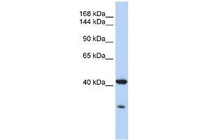 GNAS antibody used at 1 ug/ml to detect target protein. (GNAS antibody  (N-Term))