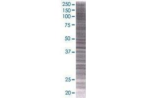 MARVELD3 transfected lysate. (MARVELD3 293T Cell Transient Overexpression Lysate(Denatured))