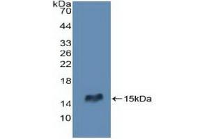 Figure. (RIPK2 antibody  (AA 432-540))