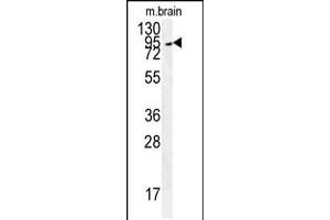Western blot analysis in mouse brain tissue lysates (35ug/lane). (GIT1 antibody  (AA 366-395))