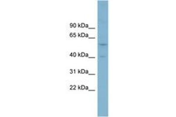 SUSD4 antibody  (AA 251-300)