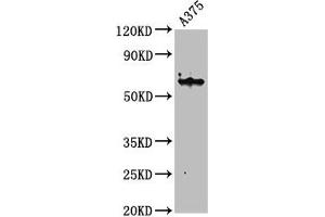 Western Blot Positive WB detected in: A375 whole cell lysate All lanes: KRT6A antibody at 4. (KRT6A antibody  (AA 2-564))