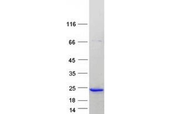 Complexin 1 Protein (CPLX1) (Myc-DYKDDDDK Tag)