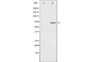 Western blot analysis of Estrogen Receptor alpha phosphorylation expression in 293 whole cell lysates,The lane on the left is treated with the antigen-specific peptide. (Estrogen Receptor alpha antibody  (pSer104))