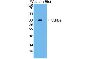 Detection of Recombinant C4, Mouse using Polyclonal Antibody to Complement Component 4 (C4) (Complement C4 antibody  (AA 1450-1723))