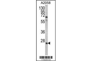 Western blot analysis of GRB2 Antibody in A2058 cell line lysates (35ug/lane) (GRB2 antibody  (AA 89-118))