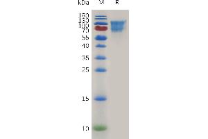 Mouse CD34 Protein, hFc Tag on SDS-PAGE under reducing condition. (CD34 Protein (CD34) (AA 35-287) (Fc Tag))