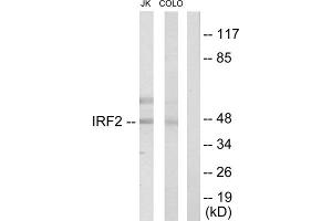 Western blot analysis of extracts from Jurkat cells and COLO205 cells, using IRF2 antibody. (IRF2 antibody  (Internal Region))