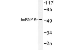 Image no. 1 for anti-Heterogeneous Nuclear Ribonucleoprotein K (HNRNPK) antibody (ABIN317794) (HNRNPK antibody)