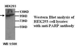 Image no. 1 for anti-Poly (ADP-Ribose) Polymerase 1 (PARP1) antibody (ABIN790911) (PARP1 antibody)