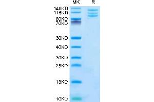 SDS-PAGE (SDS) image for Integrin AlphaV Beta6 (ITGAV/ITGB6) (AA 31-988) protein (His tag) (ABIN7275074)