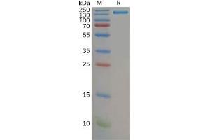 Human CD21 Protein, hFc Tag on SDS-PAGE under reducing condition. (CD21 Protein (AA 21-971) (Fc Tag))