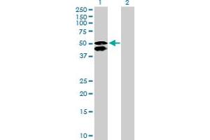 Western Blot analysis of CALCOCO2 expression in transfected 293T cell line by CALCOCO2 MaxPab polyclonal antibody. (CALCOCO2 antibody  (AA 1-446))