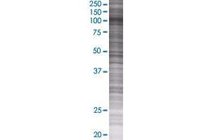 Western Blotting (WB) image for BRD2 293T Cell Transient Overexpression Lysate(Denatured) (ABIN1333327)