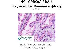 Image no. 1 for anti-G Protein-Coupled Receptor, Family C, Group 5, Member A (GPRC5A) (2nd Extracellular Domain) antibody (ABIN1735207) (GPRC5A antibody  (2nd Extracellular Domain))