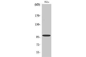 Western Blotting (WB) image for anti-Catenin-alpha E/N (C-Term) antibody (ABIN3174190) (Catenin-alpha E/N (C-Term) antibody)