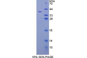 Image no. 1 for Galectin 4 (LGALS4) (AA 1-326) protein (His tag) (ABIN4988379) (GAL4 Protein (AA 1-326) (His tag))