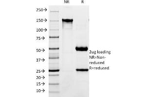 SDS-PAGE Analysis Purified CD171 Mouse Monoclonal Antibody (SPM275). (L1CAM antibody)