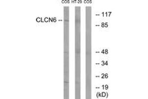 Western Blotting (WB) image for anti-Chloride Channel, Voltage-Sensitive 6 (CLCN6) (AA 611-660) antibody (ABIN2890213) (CLCN6 antibody  (AA 611-660))