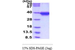 CRMP1 Protein (AA 1-572) (His tag)