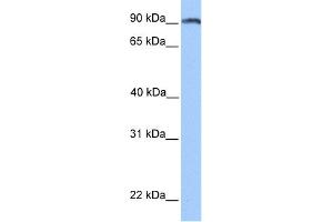 WB Suggested Anti-ANKS3 Antibody Titration: 0. (ANKS3 antibody  (N-Term))