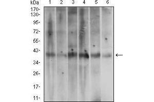 Western blot analysis using ACP5 mouse mAb against A431 (1), T47D (2), HepG2 (3), MOLT4 (4), Jurkat (5) and Hela (6) cell lysate. (ACP5 antibody  (AA 221-325))