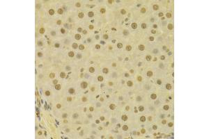 Immunohistochemistry of paraffin-embedded human liver using COPS5 antibody. (COPS5 antibody)